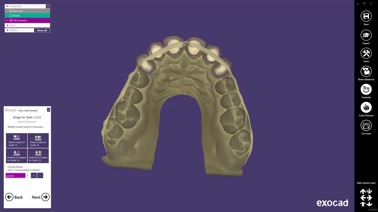 Impression 3D dentaire CAO